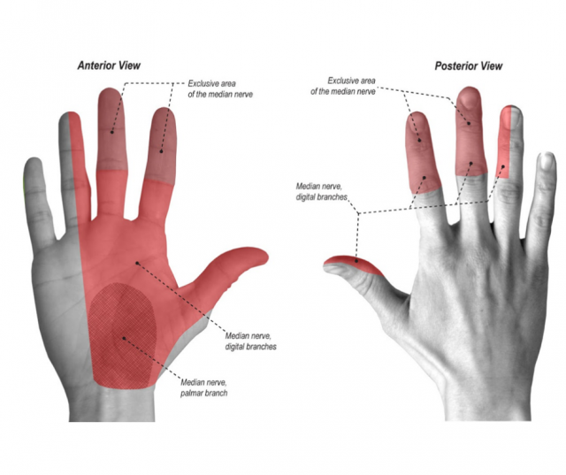 Carpal Tunnel Syndrome - Active Health